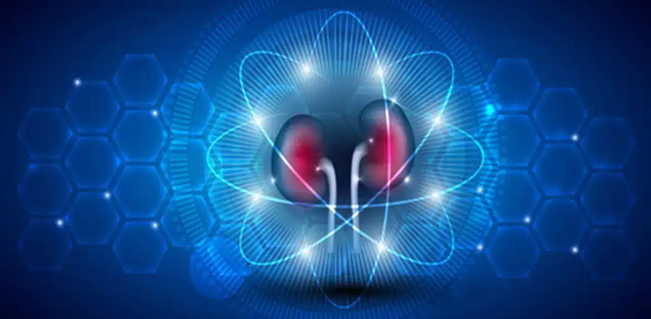 kidney cancer