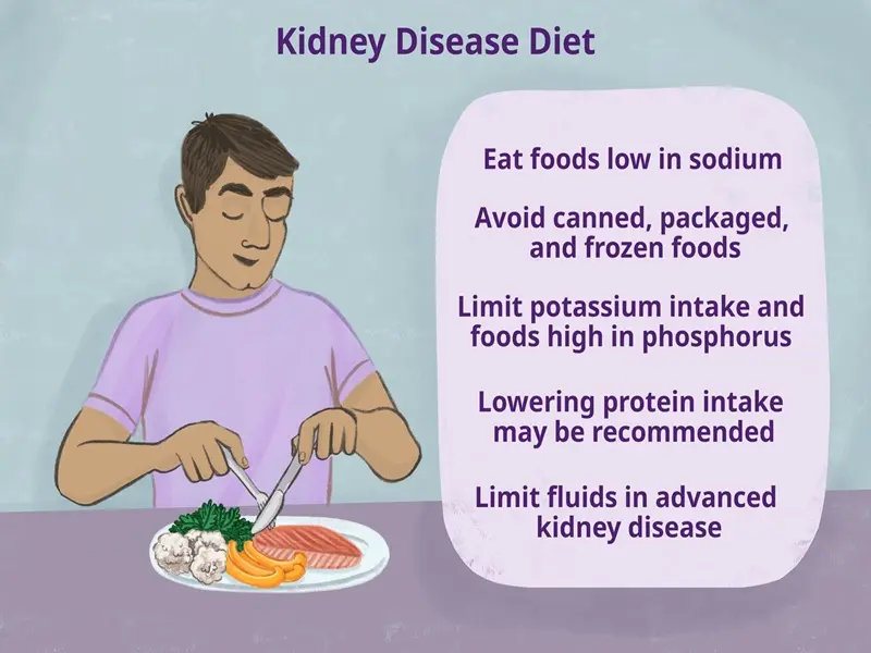 Diet for Kidney Disease Management