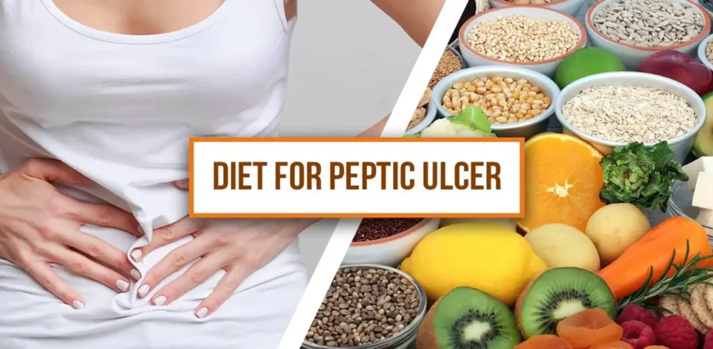 Effective Peptic Ulcer Diet