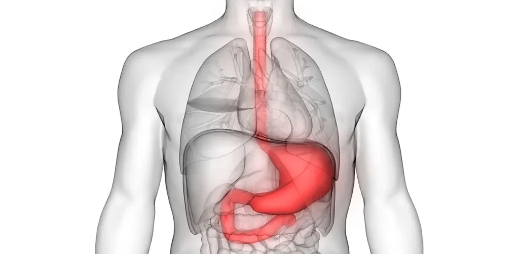 Managing Rapid Gastric Emptying