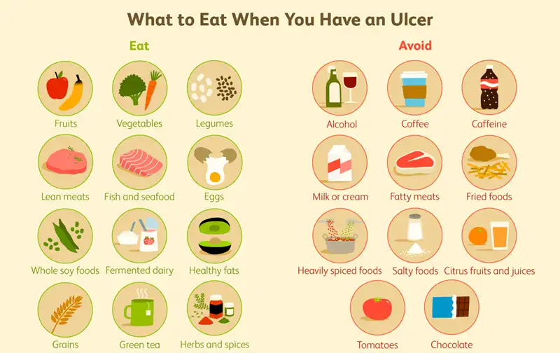 Peptic Ulcer Diet What to Eat and Avoid